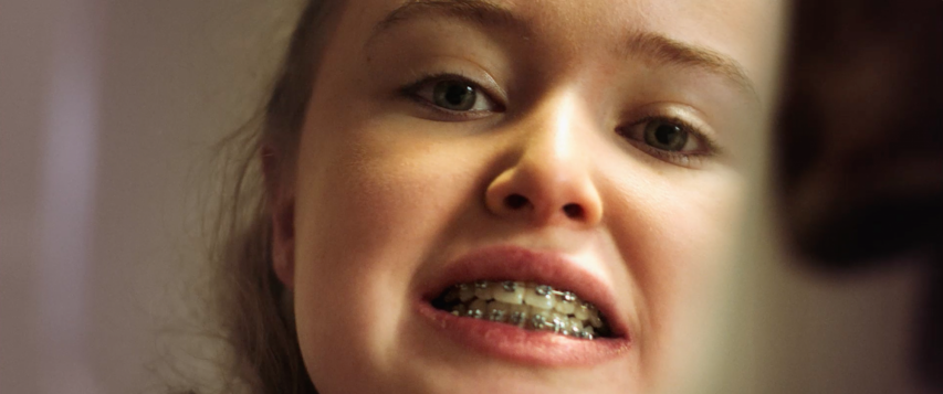 Kelly looking at her new braces in the mirror